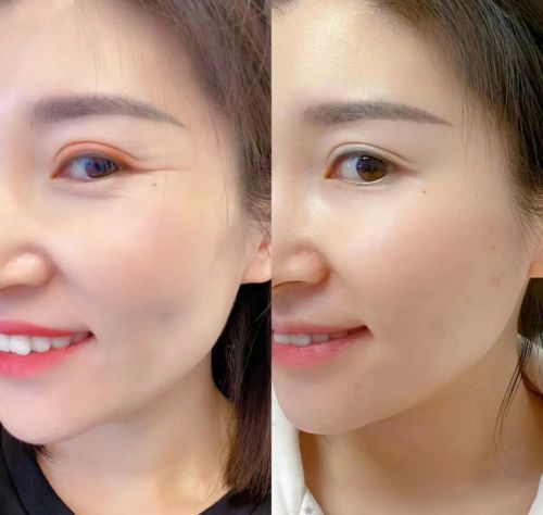 摆脱衰老问题五款抗老非常好用的眼霜AG真人百家乐抗老眼霜哪个效果好？(图7)